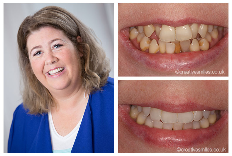 Dental Testimonials