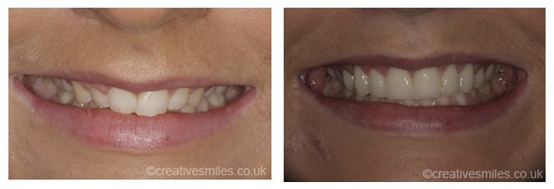 Dental Treatment Testimonials