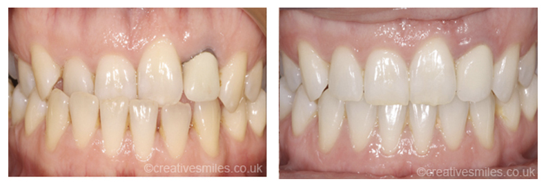 Dental Treatment Testimonials