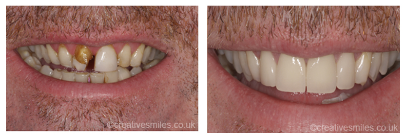 Dental Treatment Testimonials