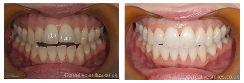 Dental Treatment Testimonials