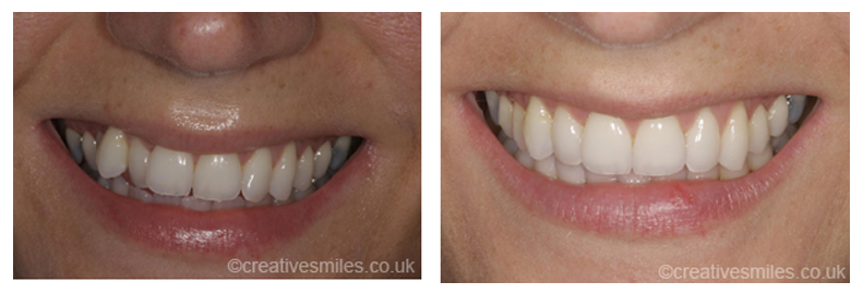 Dental Treatment Testimonials