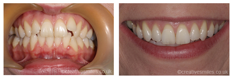 Dental Treatment Testimonials