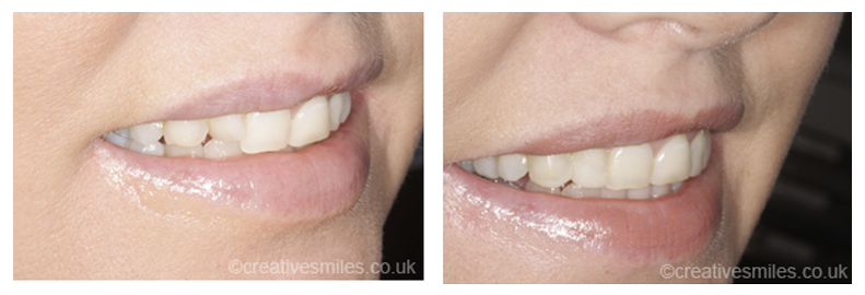Dental Treatment Testimonials